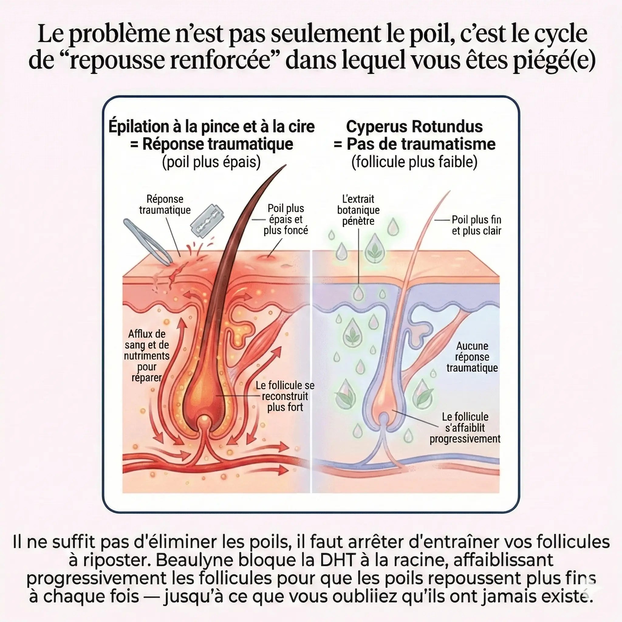 Beaulyne Sérum à la Cyperus Rotundus – Stoppe naturellement la repousse des poils indésirables